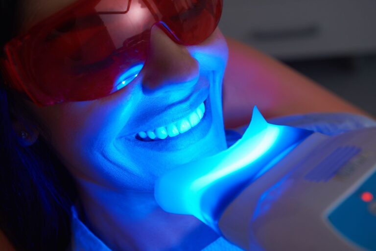 The Benefits of Professional Teeth Whitening vs. Over-the-Counter Products