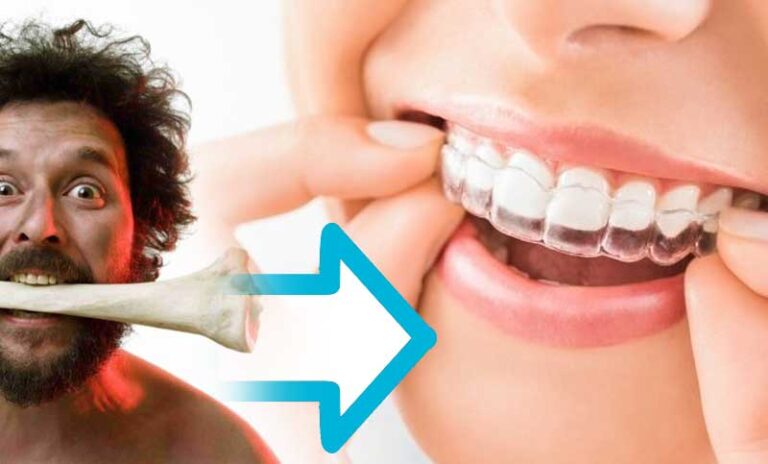 From Cavemen to Clear Aligners: The Evolution of Dental Care