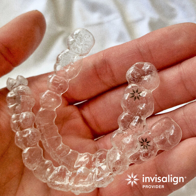 5 Things You Need to Know Before Starting Your Invisalign Journey